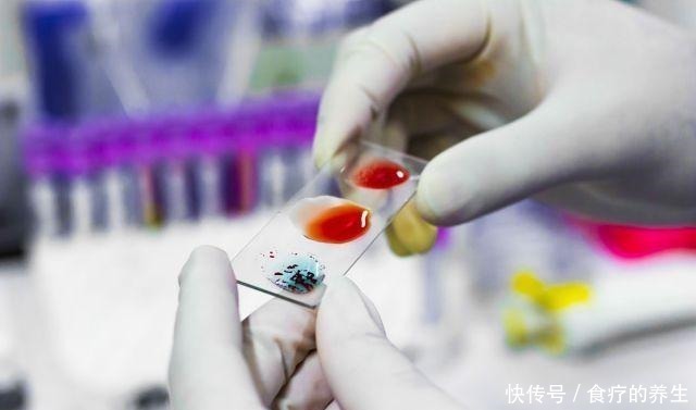 智力|作为万能血的O型血,与什么血型生出的宝宝更聪明你找对人了吗!