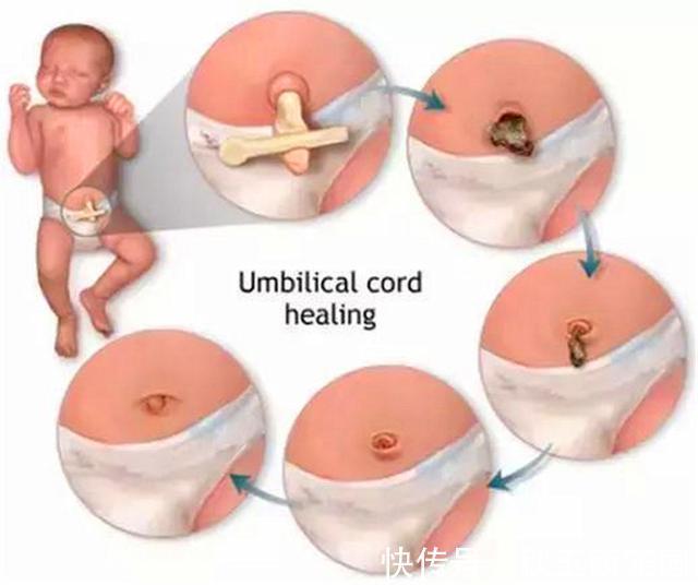 肚子疼!肚脐眼里的“泥”到底是啥?能不能抠?显微镜放大1000倍,真酸爽