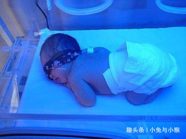 宝宝|广东一婴儿黄疸入院2天,去世原因变4个,新生儿黄疸有这么严重吗