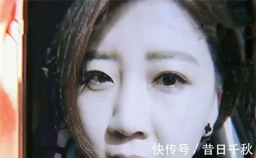 整形|女子整形失败化脓, 整形机构笑着回答 是你个人体质问题!