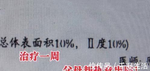 秘方|父母嫌医药费贵求助江湖医生，用秘方给幼童治烫伤致其感染身亡