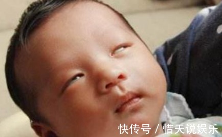宝宝|刚出生2个月宝宝总翻白眼，宝妈担心，医生检查后，宝妈却乐坏了