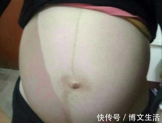 贴身物|怀孕晚期被诊断胎停育,医生怒斥太可惜太无知