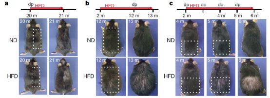 毛发|讲一件悲伤的事：肥胖会加重脱发