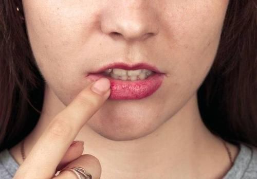 嘴唇干燥起皮，或是这5个原因，很多人都没注意!