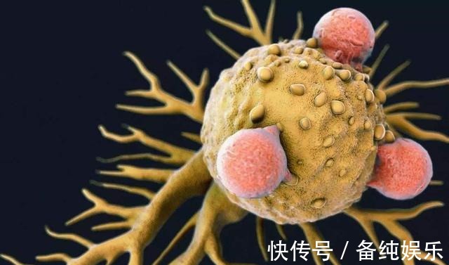 炎症|从炎症到癌症,警惕以下7种炎症成为癌症“帮凶”