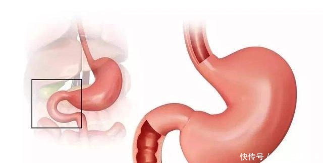 消化科医生提醒别把这2种水果当零食了,伤胃!胃不好的人少吃