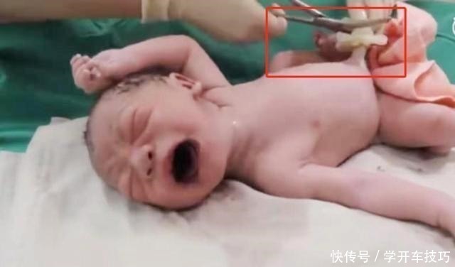 生娃|宝宝出生后被带走十几分钟,这段时间经历了什么组图带你看真相!