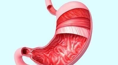 患者|胃炎怎么办,多吃“4宝”,修复胃黏膜,现在知道还来得及