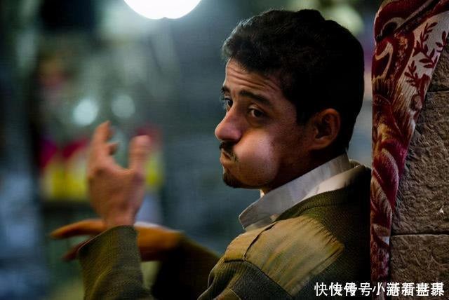 唯一以“树叶”为食的国家,当地人吃到脸变形,还忍不住天天吃