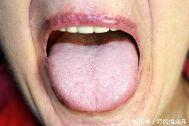 肝瘿线|身体里有肿瘤，舌头上也会有表现！出现3种异象需小心