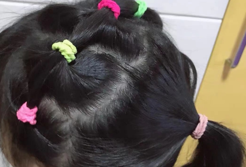 幼儿园老师|看到幼儿园老师给孩子扎的头发,宝妈心疼极了,怒斥太不负责了