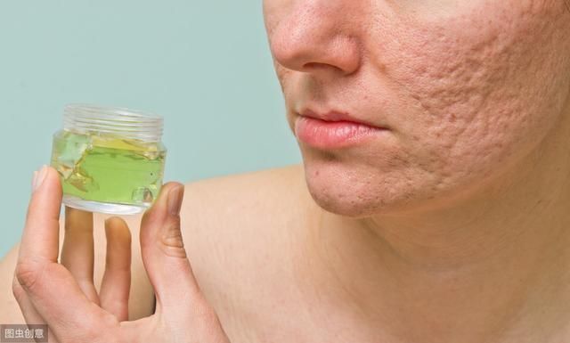 毛孔越来越粗大,这些坏习惯你却一直在做,别再怪护肤没用了!