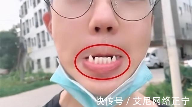 刷牙|17岁儿子长尖牙,亲妈吐槽像“吸血鬼”,网友:也可能是个狼人