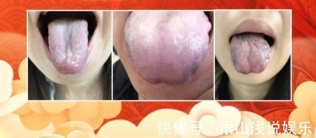 黑豆|血瘀生百病！中医推荐4个活血化瘀宝贝，针对不同的血瘀体质！