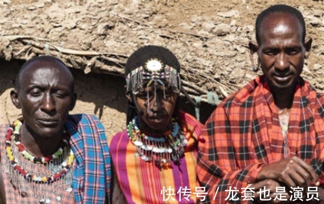 病人@非洲版“唐僧”:皮肤全白,血液比黄金还贵,死后遗骸能卖上百万