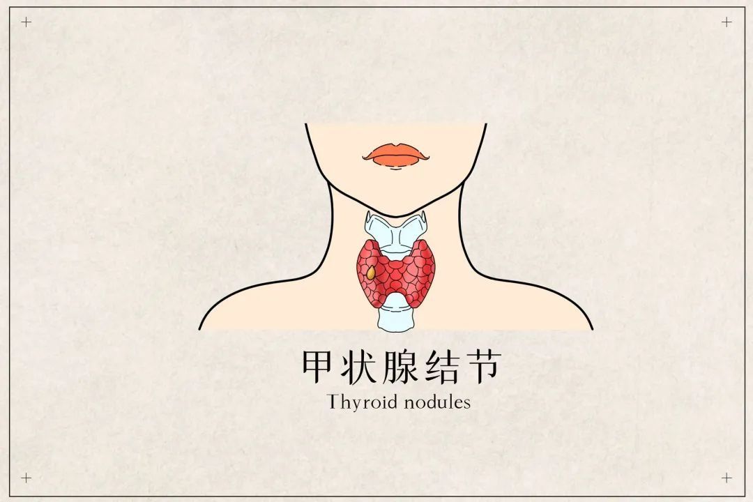 预警|【健康科普】癌症到来的这几个预警信号，千万要注意！