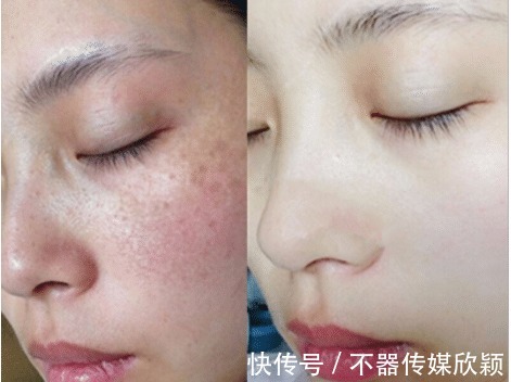 产品|祛斑产品千千万,用空瓶的只有这3款,皮肤干净得像剥了壳的鸡蛋