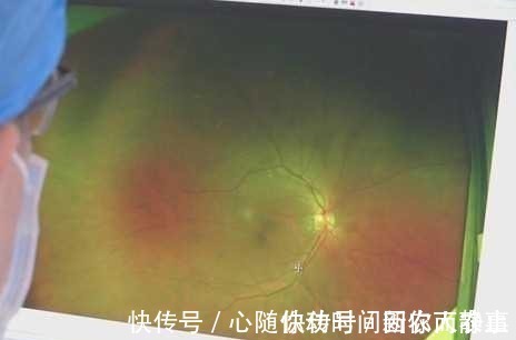 万幸|广东一男子周末“钓鱼自由”，结果眼睛躺枪，网友：不幸中的万幸