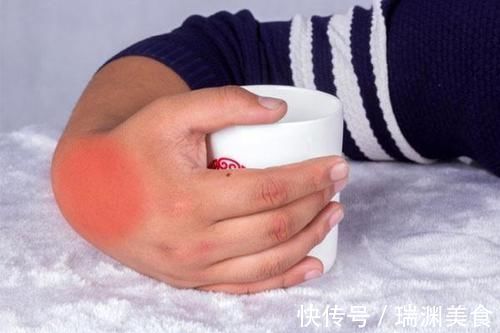 尿酸|痛风的福星已找到，尿酸高的人如果每天吃点，可以远离痛风烦恼