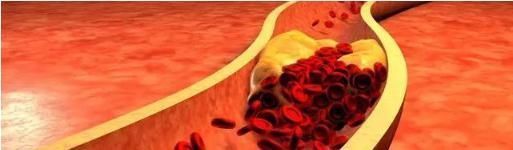 医生|丹参片能不能长期服清理血管垃圾?看完医生这篇文章就知道了