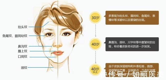 抗衰 手术除皱多少钱，怎么做？效果咋样？超全抗衰攻略助你摆脱年龄数字！