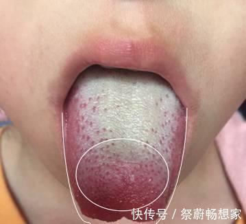 十娃九积|孩子积食不长个,宝妈做了两方面调整,娃一年内长高了二十五厘米