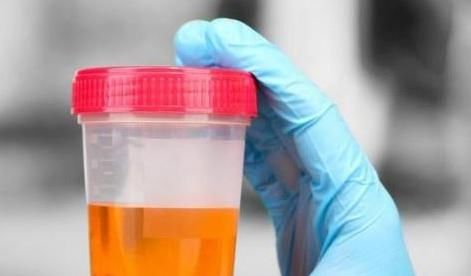  早晨|当肝脏开始生病时，早晨起床后有四种表现，如果没有那肝还不错！