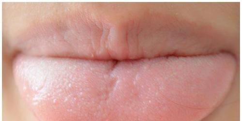  舌头|舌头对应五脏健康，没事咬咬舌头，排出肝毒，肾脏也变好了