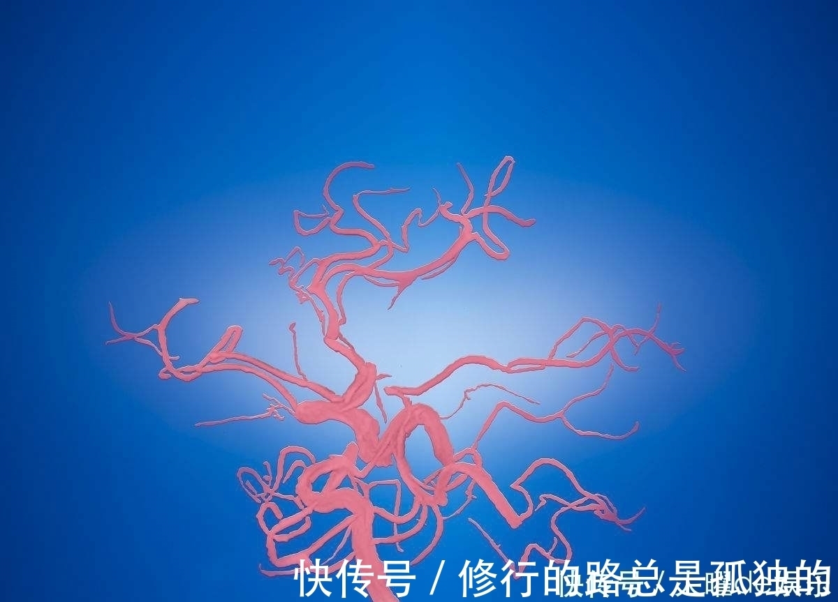 脑出血|患上脑出血的第一个信号,常常是这种异常,高血压人群要注意