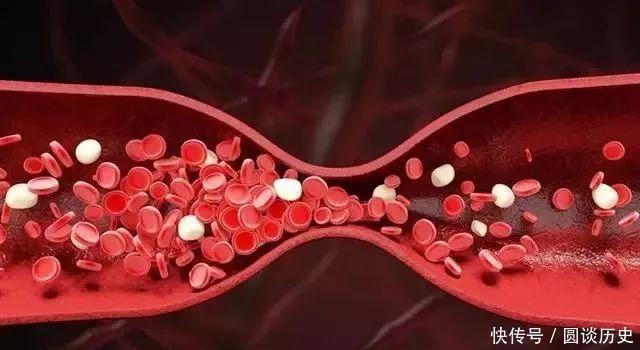 脑袋里有没有血栓,就看你睡觉有没有这个毛病若没有,恭喜你