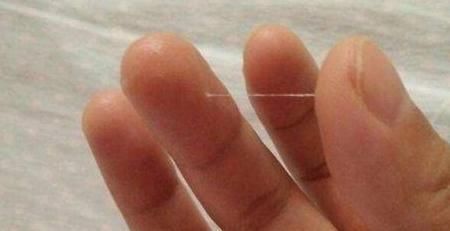 妇科健康|底裤上出现这种情况，可能是宫颈发出的“求救信号”，早知早预防