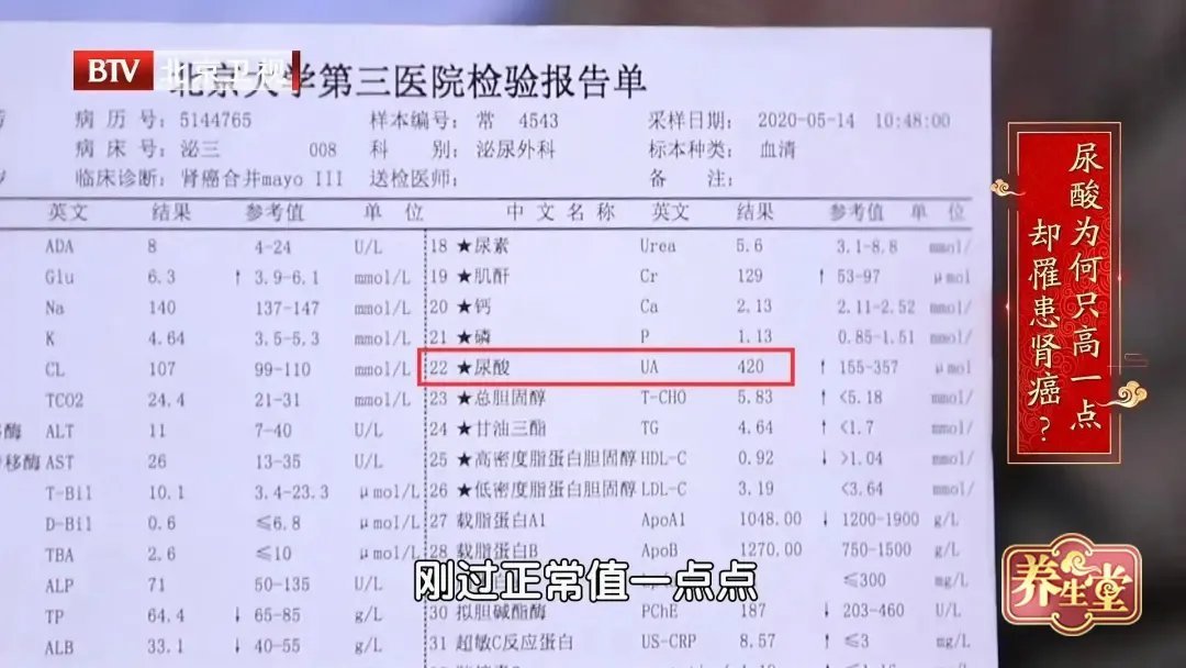 肾癌|尿酸只高一点，也可能得肾癌！少做这三件事，把尿酸降下来~