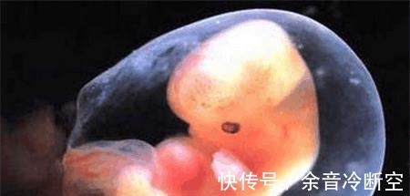 患儿|孕6月检查发现孩子唇腭裂三级, 这些伤害胎儿的行为孕妈不要再做了!