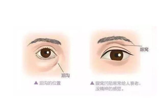 凹陷处|人体自带8个“养生窝”,坚持按揉百病除,让你不浪费钱买保健品