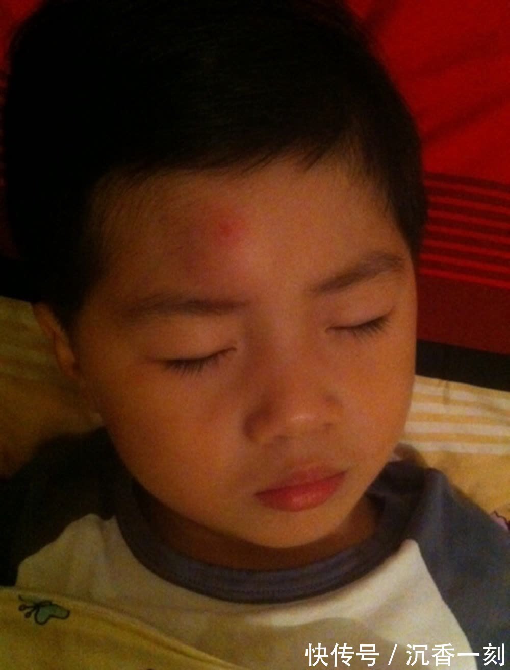 蜂刺|江西出生4天婴儿被蜱虫咬伤,夏季驱虫“三及时”,不让娃白遭罪
