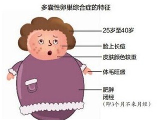 排卵|李俊芳告诉你治疗多囊卵巢疾病