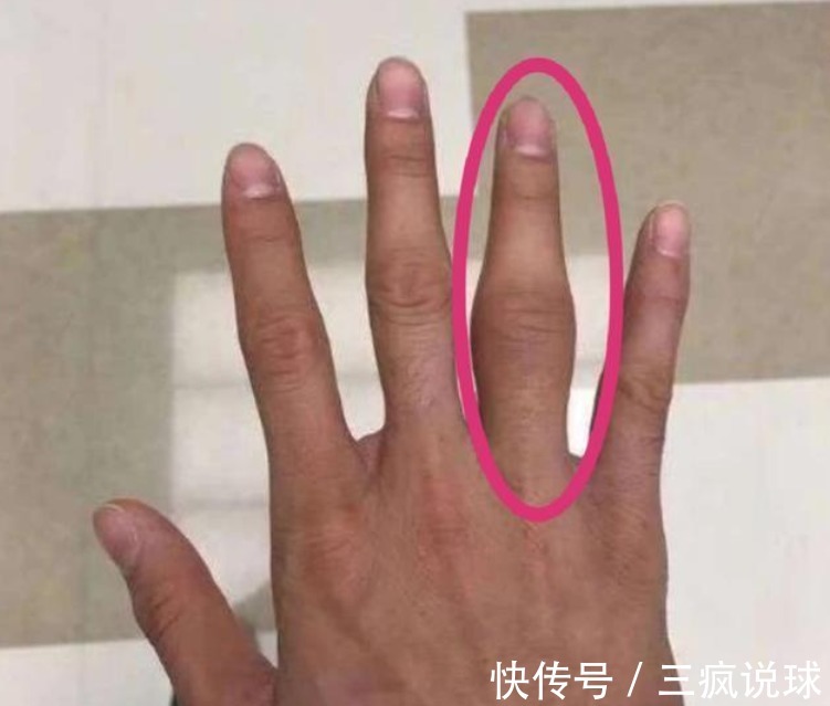 赛季|辽宁新赛季堪忧!郭艾伦突传坏消息,杨鸣争冠还没开始就遭重创