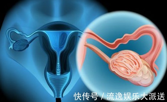 检查|宫颈有癌,月经先发现, 月经有2个变化,不要拖拉,早去检查