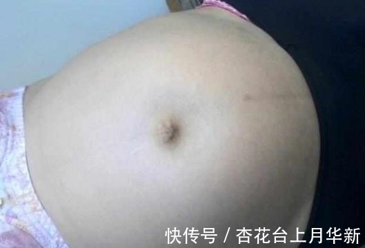 吓坏|孕妇分娩后肚子疼，医院检查后，检查结果把家人吓坏了