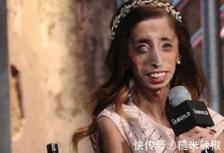 丽斯|她是世界上最瘦最丑的女人，体重不超过29公斤，却活出最美丽样子