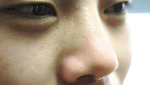 经常用手“抠鼻孔”的人,早晚都会受到“恶果”,希望你管住手