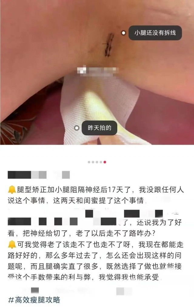 动物|离谱！外貌焦虑已经“卷”到动物身上了