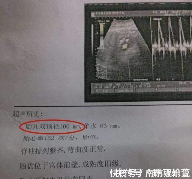 胎儿|想顺产胎儿的双顶径有何要求?最好别超出此范围,否则分娩风险大
