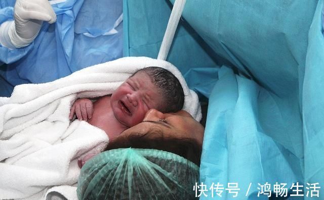 剖腹产|分娩时,胎儿离开母体一瞬间是什么感觉?听听宝妈们是怎么说的