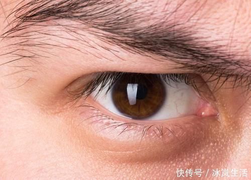 停电|做近视手术到一半,如果眼睛动了、眨了,会怎么样?