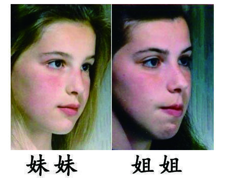 蒙头|孩子睡觉存在这种习惯,早改为好,拖得越久,越影响颜值