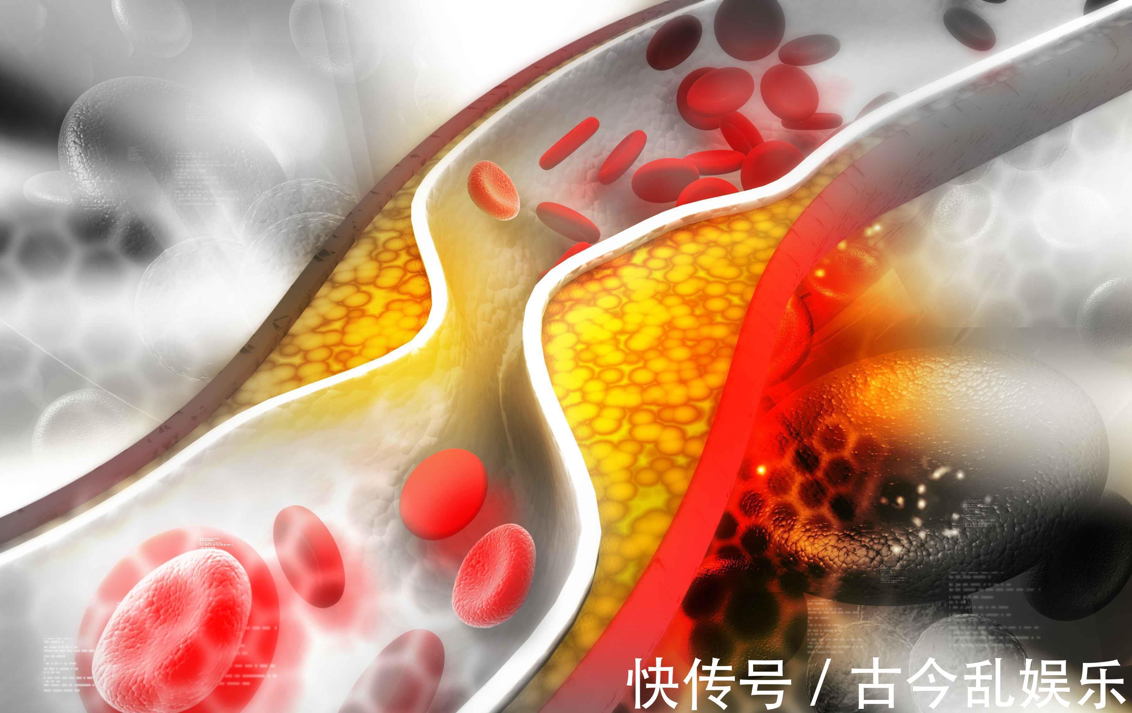 枯草杆菌|常吃这种五谷之王,保护血管,清理肠道,还能降三高、增强免疫力