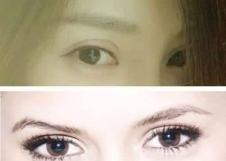 “你这双眼皮拿镰刀割的吧”扎心了……究竟多宽的双眼皮最合适