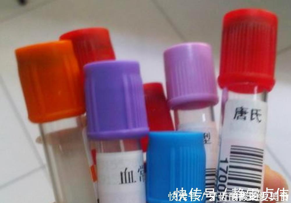 血管|一个孕期下来，孕妇要抽多少管“血”？过来人：血管都“干瘪”了